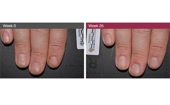 Image of fingernails