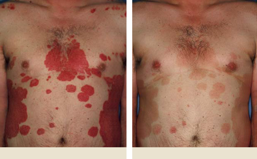 Image of chest