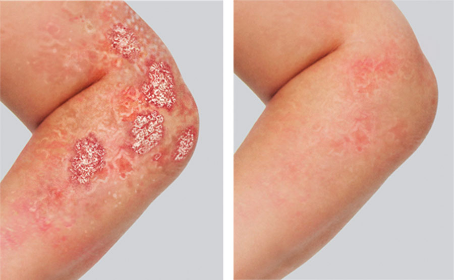 Image of arm